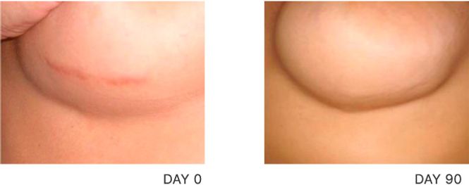 Hovedbilde SODERMIX Cream 15g